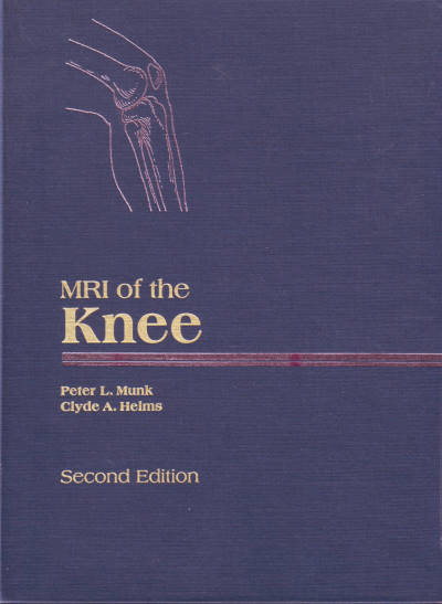 MRI of the Knee - Second Edition